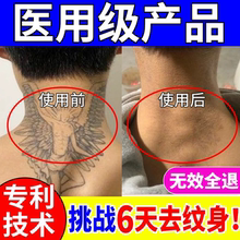 Патент на стирку татуировок безопасный без шрамов