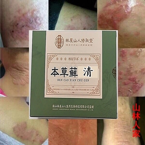 【山林人家】银癣净肤丸送外用 牛皮廯癣润肤yin屑头护肤内服牛皮癣