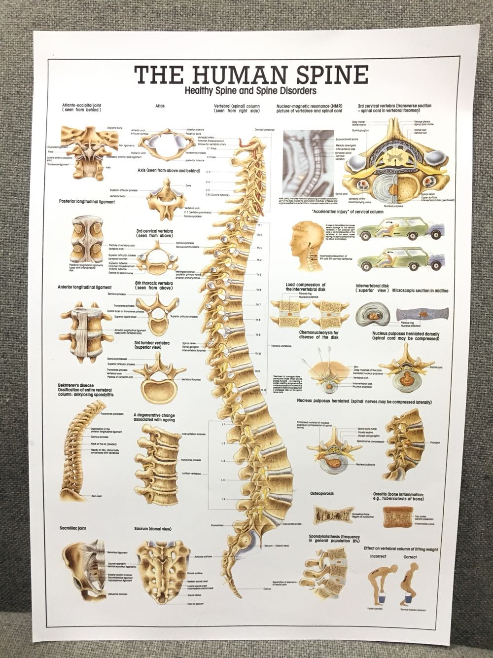 医院人体解剖图挂图人体器官结构图挂图人体脊柱脊椎骨颈椎图挂图