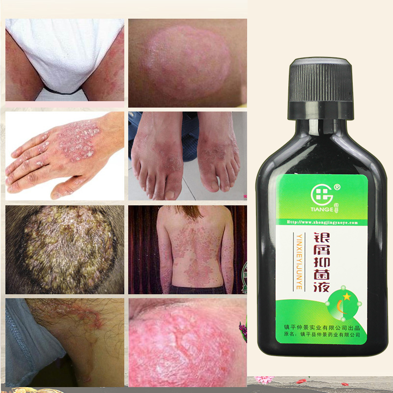 共396 件藓癣药膏相关商品